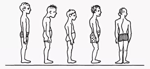 Stand -up