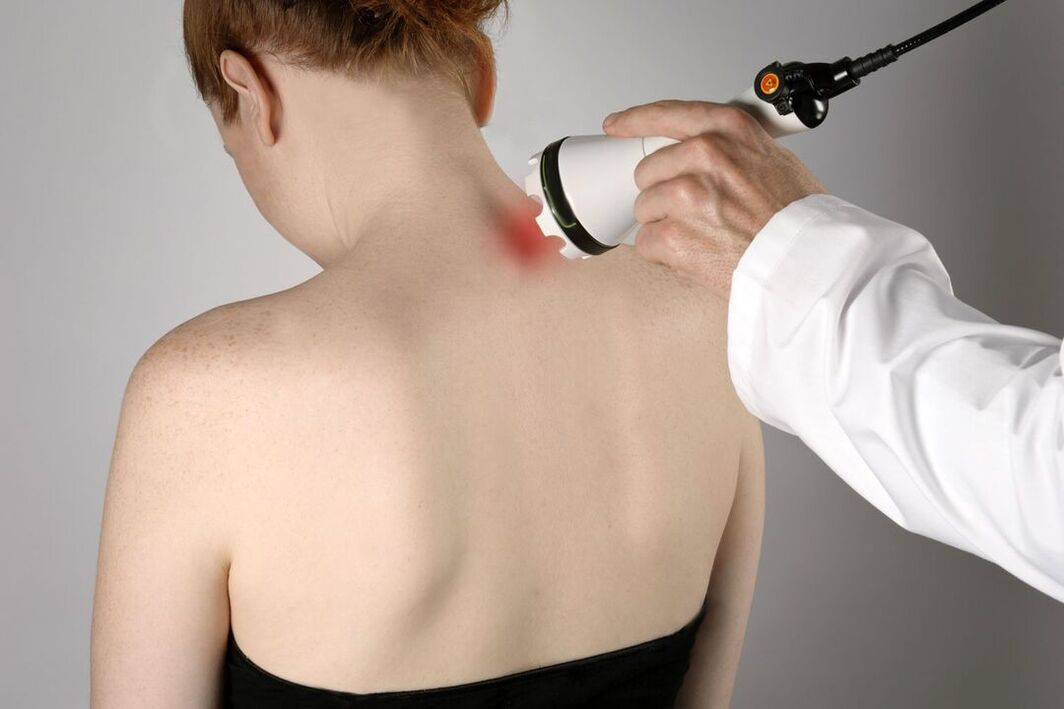Physiotherapy treatment of cervical osteochondrosis